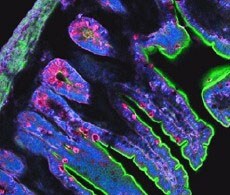 anti-chicken-secondary-antibodies-showcase anti-chicken-secondary-antibodies-showcase