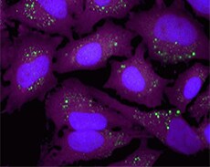 用60 µM 氯喹处理 HeLa 细胞 用60 µM 氯喹处理 HeLa 细胞