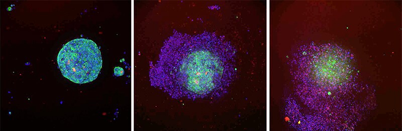 Results from CAR T cell invasion into cancer spheroids Fluorescence microscopy images of cell lysis in cancer spheroids following exposure to CAR T cells