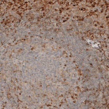 VISTA detection by IHC Microscopic image of immunohistochemical staining in human tonsil tissue