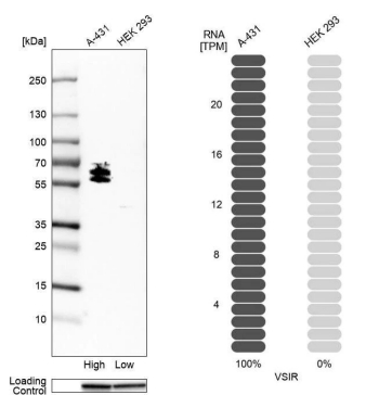 Results from VISTA detection in 2 cell lines Western blot and RNA-Seq data confirms VISTA specificity by relative expression assay
