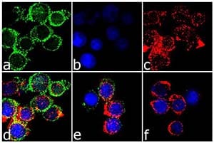 Results from CTLA-4 ELISA measurements Graph of CTLA-4 levels for responders and nonresponders