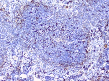 BTLA detection by immunohistochemistry Microscopic image of DAB-stained paraffin-embedded mouse tissue slice showing location of BTLA