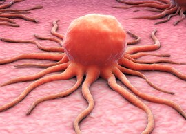 Solid Tumor Types artistic rendition of solid tumor types