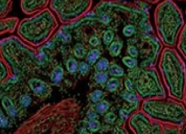 Immunofluorescence Information Immunofluorescence Information