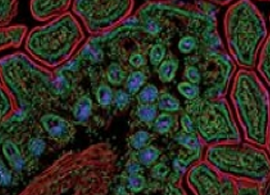 Immunofluorescence Information Immunofluorescence Information