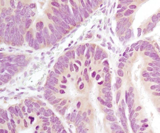 Immunohistochemistry Information Immunohistochemistry Information