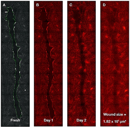 The area of a wound is calculated from a scan and the wound’s healing progress is observed over time. The area of a wound is calculated from a scan and the wound’s healing progress is observed over time.