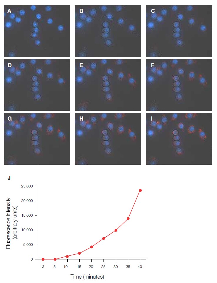 Temporal visualization of E. coli phagocytosis by murine macrophages Temporal visualization of E. coli phagocytosis by murine macrophages
