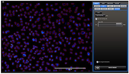 Screen capture of the quantitation of the total population of cells (blue) within the image. Screen capture of the quantitation of the total population of cells (blue) within the image.