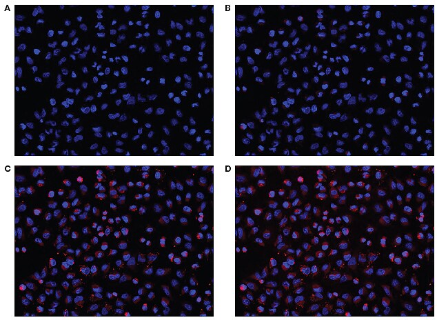 4-panel image of hypoxic cells 4-panel image of hypoxic cells