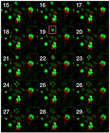 HeLa cell undergoing multipolar mitosis (red box) following transduction with CellLight Histone 2B-GFP (green) and CellLight Mitochondria-RFP (red). HeLa cell undergoing multipolar mitosis (red box) following transduction with CellLight Histone 2B-GFP (green) and CellLight Mitochondria-RFP (red).