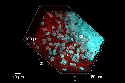 3D image of rat brain section using ProLong Glass 3D image of rat brain section using ProLong Glass