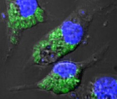 Endocytosis and Phagocytosis Information Endocytosis and Phagocytosis Information
