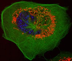 Oxidative Stress and Hypoxia Information Oxidative Stress and Hypoxia Information