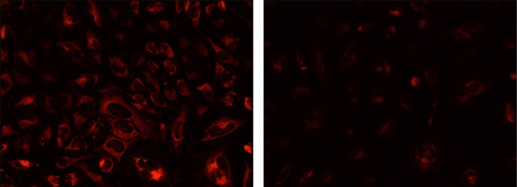 Two fluorescent cell images showing normal mitochondrial staining (left panel) and loss of staining (right panel) when cells are treated with a mitochondrial membrane disrupting agent Two fluorescent cell images showing normal mitochondrial staining (left panel) and loss of staining (right panel) when cells are treated with a mitochondrial membrane disrupting agent