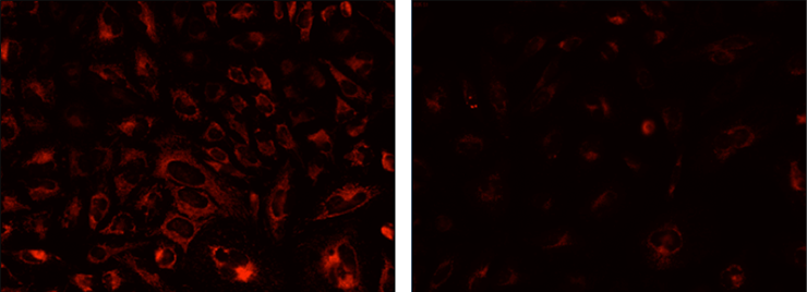 Two fluorescent cell images showing normal mitochondrial staining (left panel) and loss of staining (right panel) when cells are treated with a mitochondrial membrane disrupting agent Two fluorescent cell images showing normal mitochondrial staining (left panel) and loss of staining (right panel) when cells are treated with a mitochondrial membrane disrupting agent