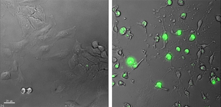 live cells showing no fluorescence (left panel) and dead cells showing bright green fluorescence (right panel) following application of a dead-cell stain live cells showing no fluorescence (left panel) and dead cells showing bright green fluorescence (right panel) following application of a dead-cell stain