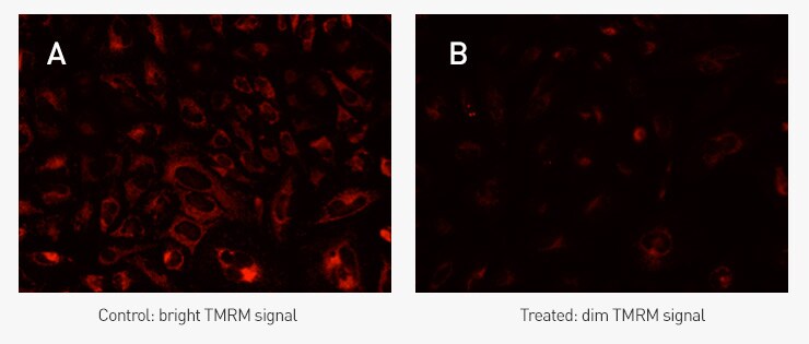 Two-panel photograph of stained cells showing red-fluorescent TMRM staining in healthy HeLa cells Two-panel photograph of stained cells showing red-fluorescent TMRM staining in healthy HeLa cells