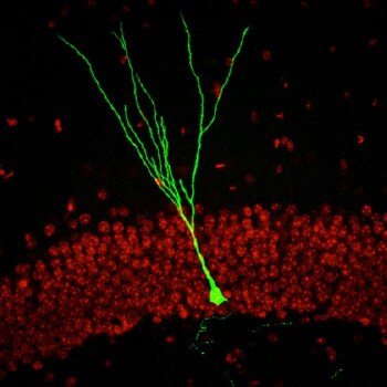 neuron, visible because it expresses GFP neuron, visible because it expresses GFP