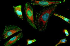 肌动蛋白细胞骨架的活细胞成像 肌动蛋白细胞骨架的活细胞成像