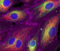 内质网 (ER) 结构 内质网 (ER) 结构