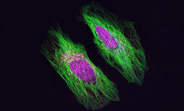 Late endosomes stained red Microscopic image of cells stained with red endosomes, green tubulin, blue lysosomes, and magenta nuclei