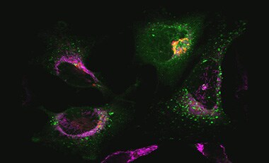 Late endosomes stained green Microscopic image of cells stained with green endosomes, red Golgi, and magenta mitochondria