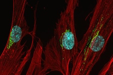 sm-golgi-complex sm-golgi-complex