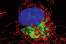 高尔基复合体结构 高尔基复合体结构