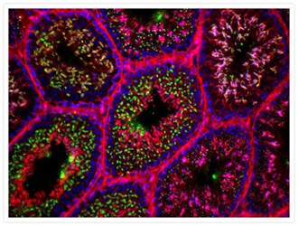 Mouse testis cross section Microscopic image of tissue stained with green lectin spermatozoa, red actin, blue nuclei