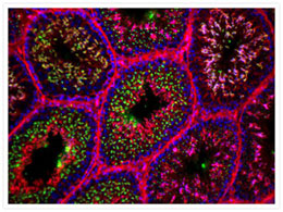 Lectin staining Microscopic image of cells stained with green lectin spermatozoa, red actin, and blue nuclei