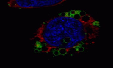 Cells undergoing oxidative stress Microscopic image of cells stained with green lysosomes, orange oxidation, and blue nuclei