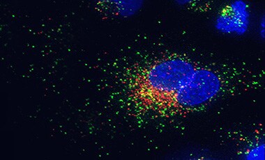 Cells undergoing endocytosis Microscopic image of cells stained with red lysosomes, green endocytosis, and blue nuclei