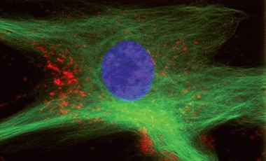 Fluorescent protein staining Microscopic image of cell stained with red lysosomes, green microtubules, and blue nucleus