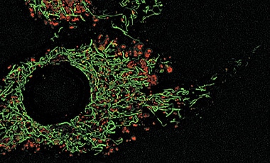 Lysosomes stained red Microscopic image of cells stained with red lysosomes and green mitochondria
