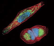 线粒体染料染色图 线粒体染料染色图