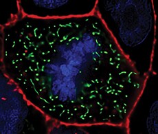 细胞膜核染料染色图 细胞膜核染料染色图