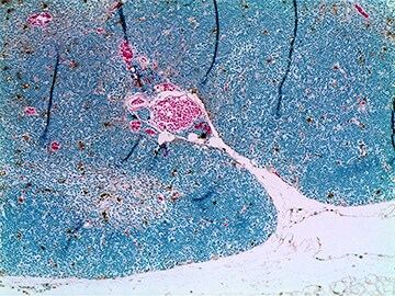 Click-iT TUNEL apoptosis assay Brightfield view of tissue section with brown nuclei, pink connective tissue and cytoplasm, and blue non-apoptotic cell nuclei