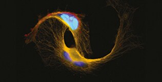 12 Apoptosis image 12 Apoptosis image