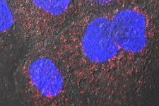 内吞作用和胞饮作用 小鼠细胞中的 pHrodo Red 葡聚糖染色