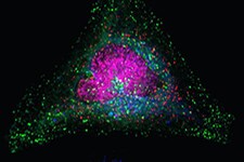 用 LysoTracker Deep Red 染色的细胞显微镜图像 用 LysoTracker Deep Red 染色的细胞显微镜图像