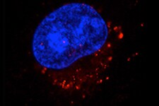 配体内化和受体内化 配体内化和受体内化