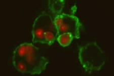 phagocytosis-wash-based 吞噬作用