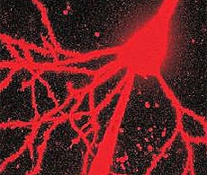 钙离子指示剂 钙离子指示剂