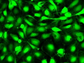 用 pHrodo Green AM 细胞内 pH 值指示剂标记的 U2OS 细胞,U2OS 细胞 用 pHrodo Green AM 细胞内 pH 值指示剂标记的 U2OS 细胞,U2OS 细胞