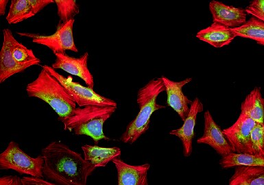Cell painting Microscopic view of fluorescent cells