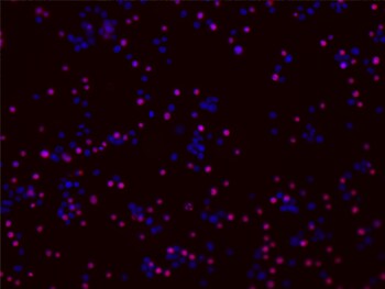 活的和热灭活的(60℃,60分钟)Jurkat细胞以50/50的比例混合 活的和热灭活的(60℃,60分钟)Jurkat细胞以50/50的比例混合