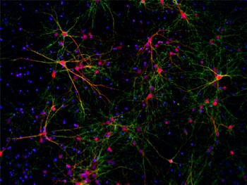 在B-27 Plus神经元培养体系中培养28天的原代大鼠皮层神经元 在B-27 Plus神经元培养体系中培养28天的原代大鼠皮层神经元