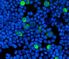 Fluorescence imaging Fluorescence imaging